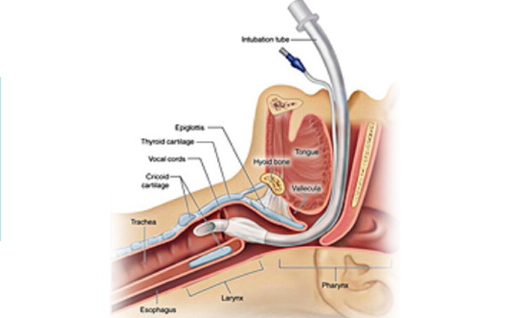Egent Centers for Ear, Nose and throat. Vocal cord surgery